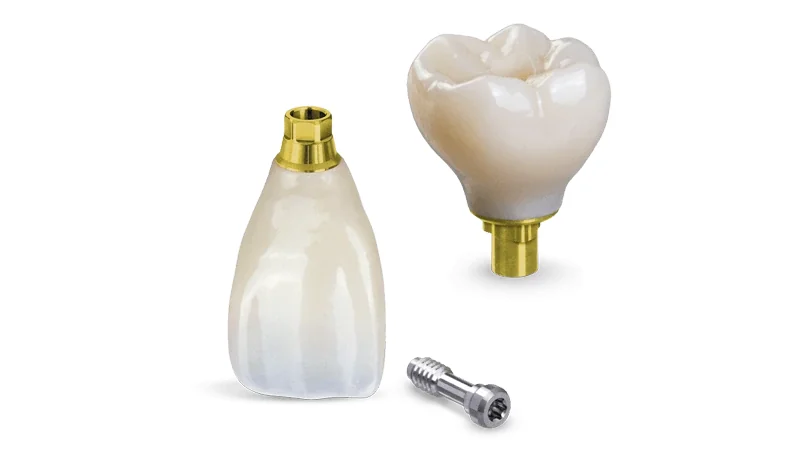 روکش مونولتیک گلس سرامیک در مجموعه ماخ